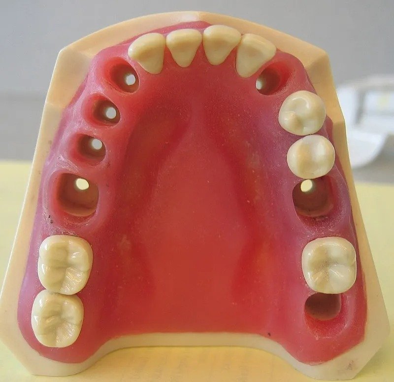 API Jaw Set with Typodonts